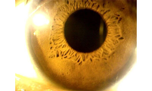 Iris Microscope