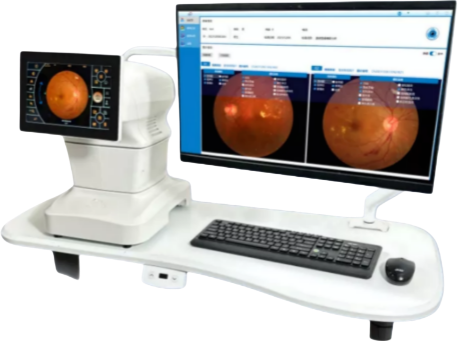 Visionix Hand Held Auto Ref-Keratometer Model Retinomax K+ Screeen